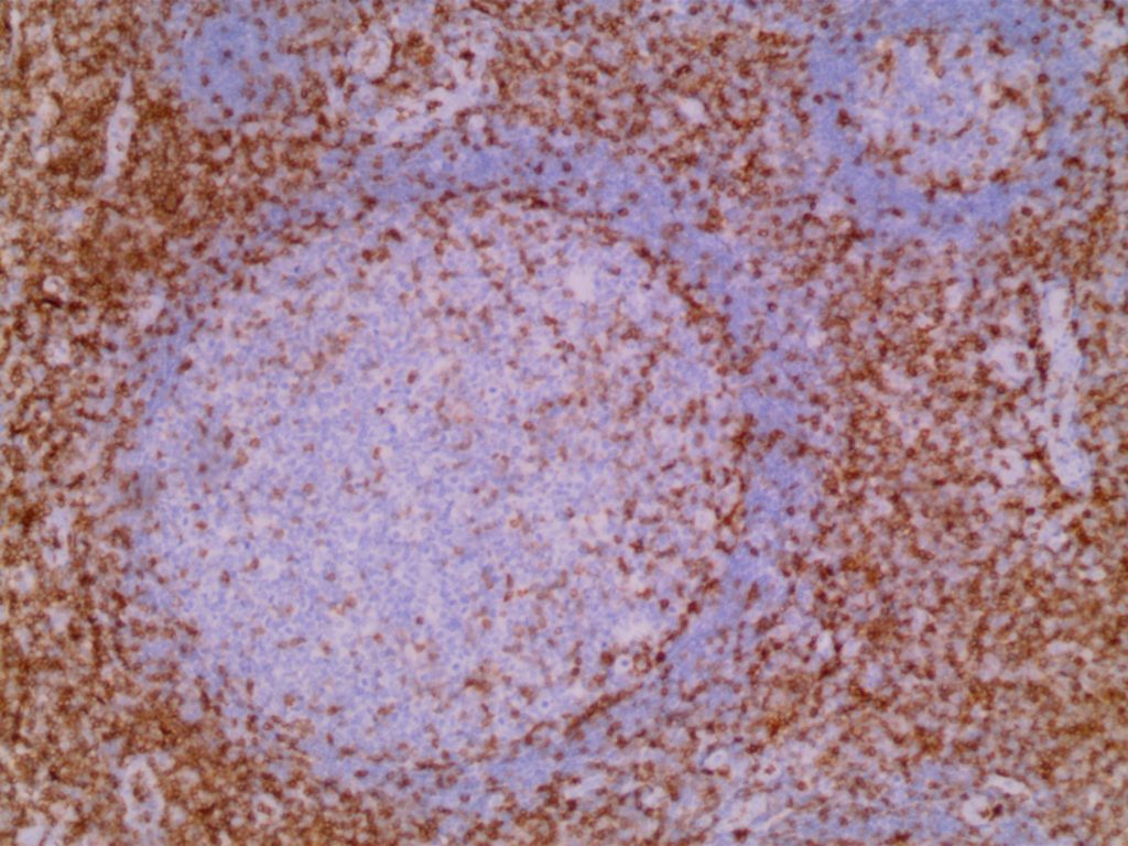 CD43 – labex